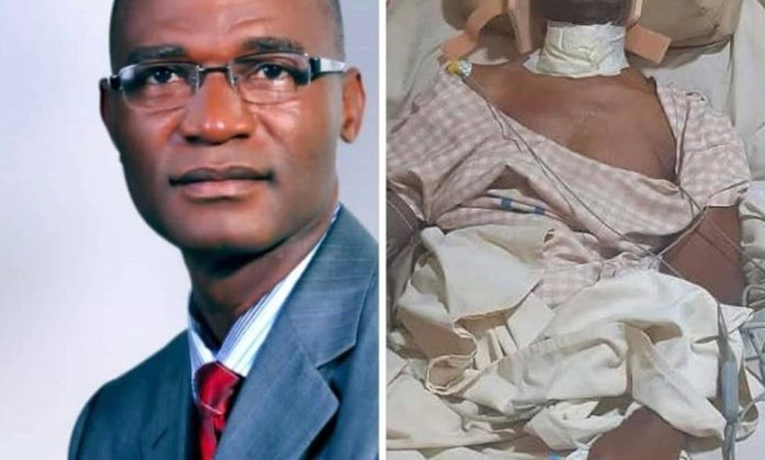 Hon Okey Akaneme before and after his ordeal in the hands of ASWAMA agents